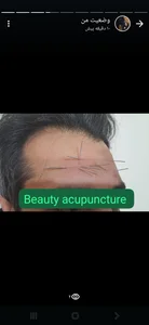 طب سوزنی شهرزاد 4