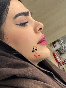 مطب زیبایی دکتر مریم آقاخانی 5
