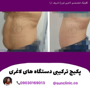 کلینیک تخصصی لاغری فروغ شریف ارا 3