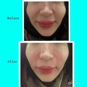 مرکز لیزر و فیشال ستاره