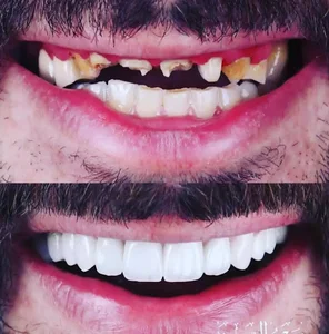 خدمات دهان و دندان امید حسینی