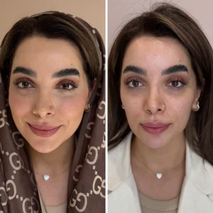 کلینیک زیبایی و لاغری میرای 5