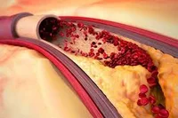 مشاوره ودرمان از روی زبان وقدووزن