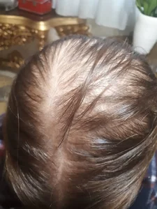 فیشیال و پاکسازی صورت مژگان 3
