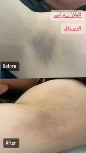 کلینیک لیزر و طب سنتی توک 4