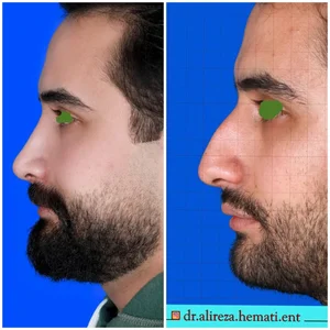 دکتر علیرضا همتی 3