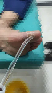 کلینیک تخصصی زخم