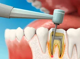 دندانپزشکی سلام خمین
