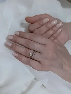کاشت ناخن لوتوس 5