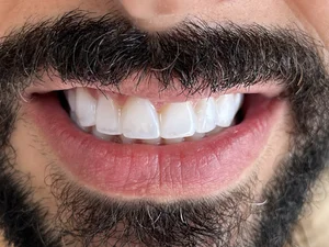 مطب دندانپزشكي دكتر بهار ابراهيمي