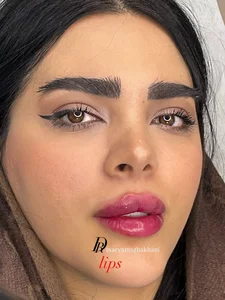 مطب زیبایی دکتر مریم آقاخانی 3