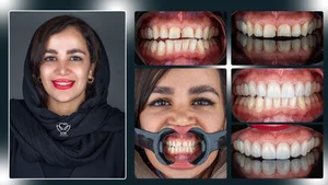 مطب ازاد
