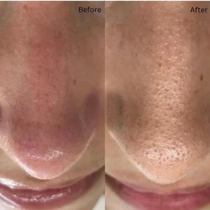 کلینیک فیشال و پاکسازی پوست اصفهان 3