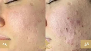 آموزشگاه مراقبت زیبایی لیلازیبایی سارینا