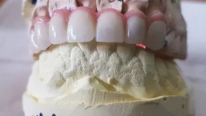 لابراتوار دندانسازی توماس