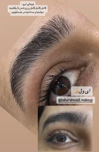اصلاح ابرو تخصصی هاشوری 3