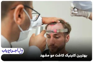 کاشت مو