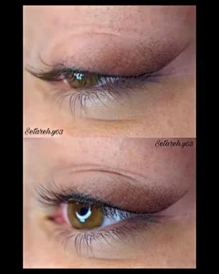 خدمات تخصصی تاتوی صورت ستاره