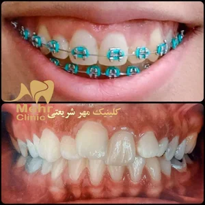 کلینیک دندانپزشکی مهر شریعتی 4