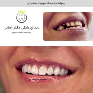 دندانپزشکی دکتر زمانی 4
