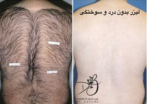 مرکز لیزر و زیبایی دایمون 5
