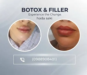 خدمات زیبایی وپوستی هدی بیوتی صاکی