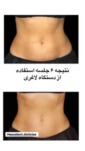 کلینیک زیبایی، لیزر و تغذیه دکتر حسنلو 4