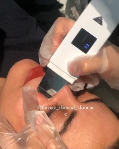 فیشال و پاکسازی پوست فرناز 3