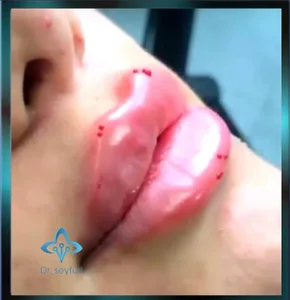 کلینیک پوست مو زیبایی دکتر سیفوری 3