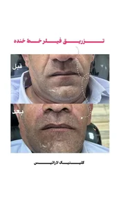 کلینیک زیبایی لاراتیس دکتر علی محدث 5