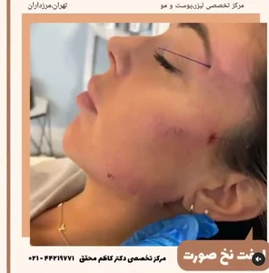 کلینیک لیزر پرتو