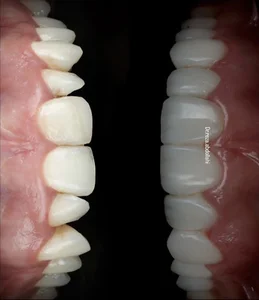 دندانپزشکی آوی - مطب دکتر فائزه اولیائی