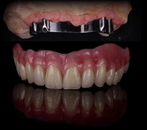 Aaj Dental Lab