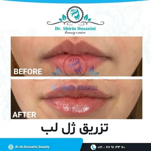 مرکز زیبایی مهرآفرین 3