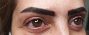 خدمات حرفه ای میکروپیگمنتیشن 5