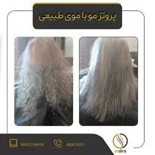 میکرواسکالپ