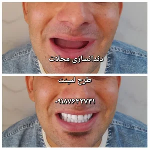 دندانسازی مرصاد محلات