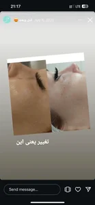 خدمات تخصصی پوست و مو مریم نصیرپور 4
