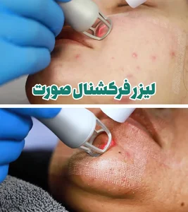 لدورابیوتی