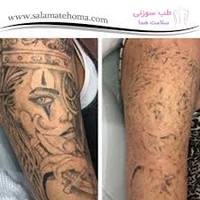 ریمو تتو شهرکرد
