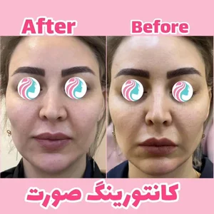 مرکز لیزر و زیبایی زروانی 4