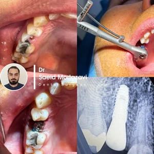 دندانپزشکی دکتر سعید مرتضوی و دکتر فرناز همتی 3