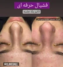 پوست مو کمالی