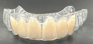 لابراتوار تخصصی ارتودنسی حبیبی (سازنده تخصصی اورال اپلاینس یا دستگاه دهانی خروپف) 2