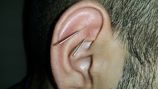 مطب دکتر علی امیری traditional medicin