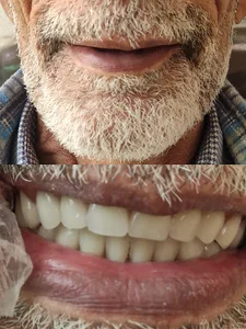 دندانپزشکی و دندانسازی نواب