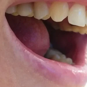 کلینیک دندانپرشکی ایمپلنت دکتر جلیل زاده 3