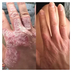 طب سنتی مزاج شناسی و درمان بیماریها