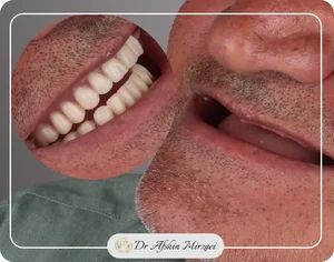 Dental Clinicكلينيك دندانپزشكي زيبايي و ايمپلنت