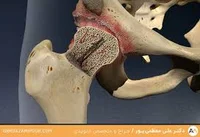 دکتر مهرنوش مهربد - جراح و متخصص ارتوپدی استخوان و مفاصل